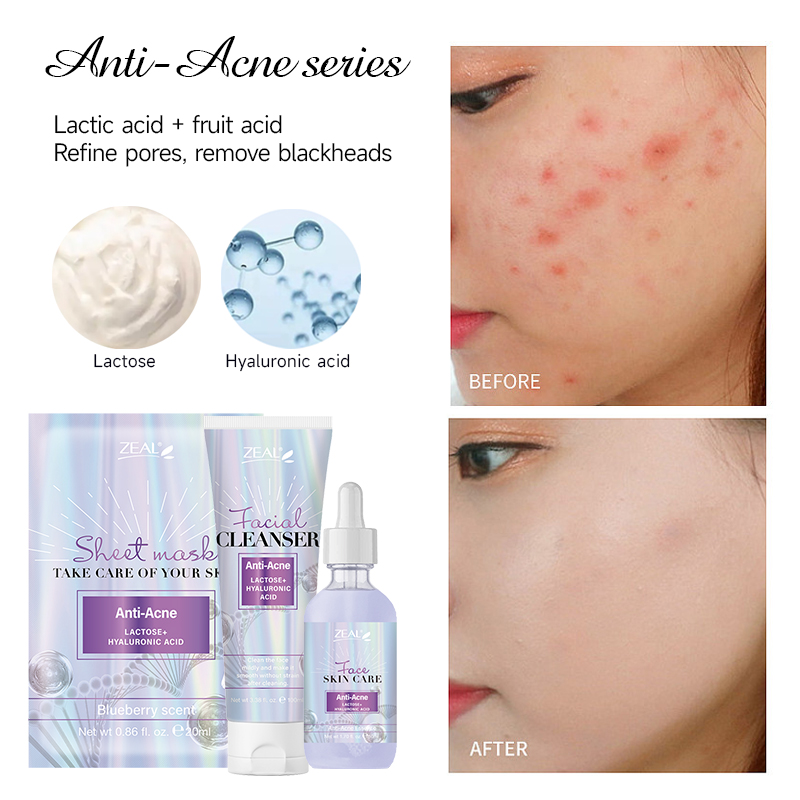 祛痘01.Dispelling acne.jpg